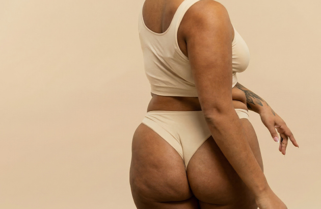 Cos'è la cellulite?