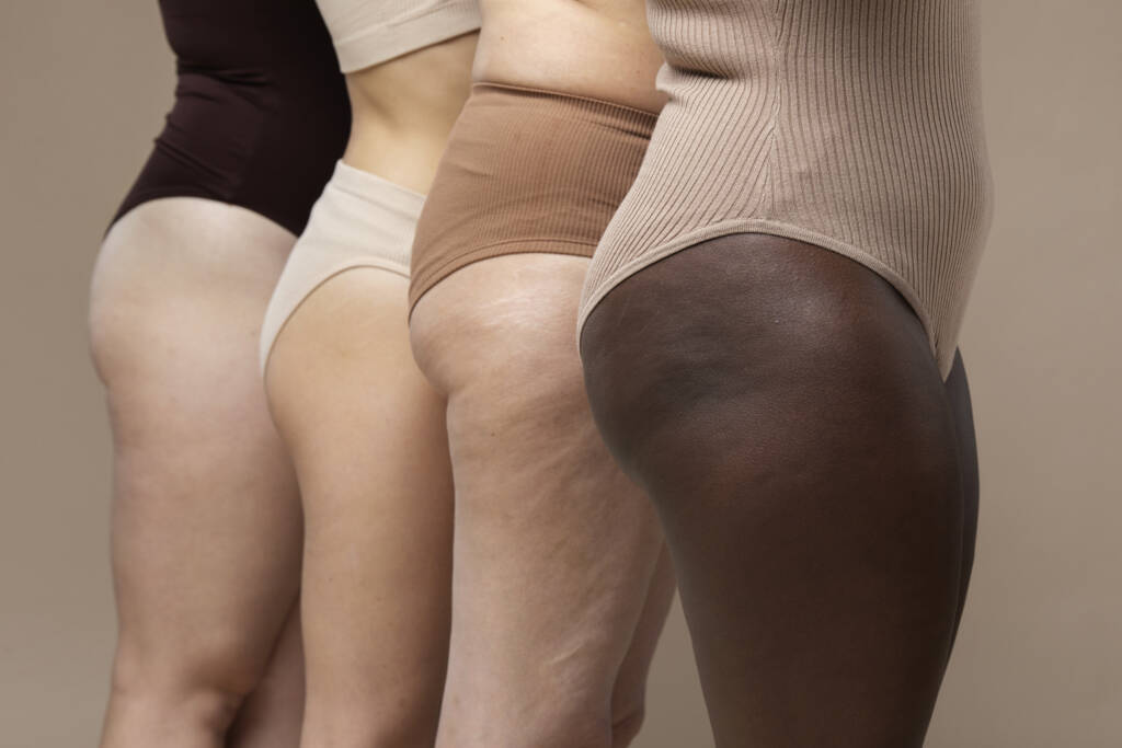 Cuscinetti adiposi, cellulite e ritenzione idrica: differenze e trattamenti efficaci