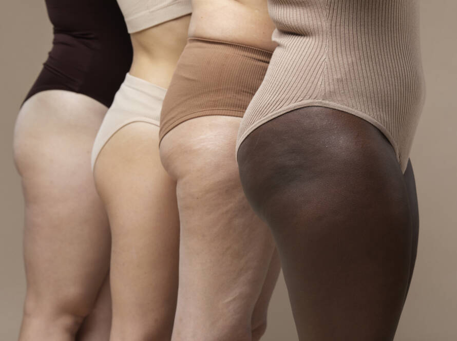 Cuscinetti adiposi, cellulite e ritenzione idrica: differenze e trattamenti efficaci